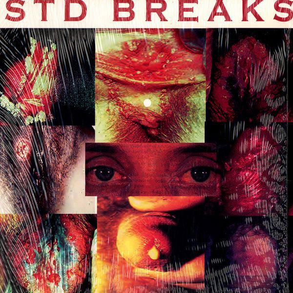 The Wax Fondler : STD Breaks (LP)